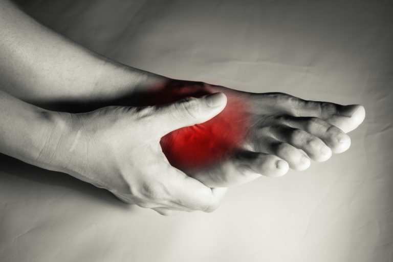 foot arch pain causes